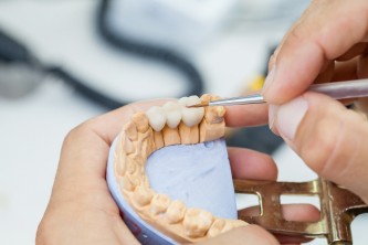 Implantat wird angemalt